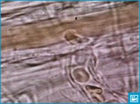 Движение эритроцитов по капиллярам (видео)