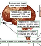 Клиника менингитов