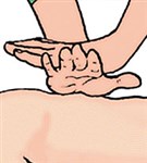 Непрямой массаж сердца