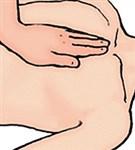 Непрямой массаж сердца одной рукой у подростка