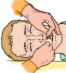 Обеспечение проходимости верхних дыхательных путей