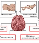 Осложнения менингококкового менингита