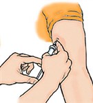 Подкожная инъекция