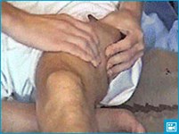 Разминание бедра