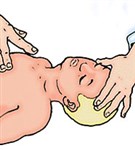 Реанимация ребенка