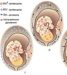 Резус-фактор в акушерской практике
