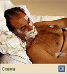 Сон (стандартное расположение электродов для регистрации Э.Э.Г., Э.О.Г., Э.М.Г.)