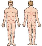Участки тела для подкожных инъекций