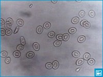 Эритроциты (видео)