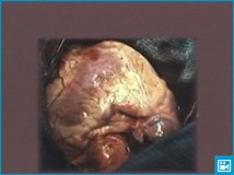 Сокращения сердца (видео)