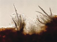 АНТРАКНОЗЫ (Гриб коллетотрих)