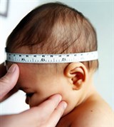 Антропометрия (измерение черепа)