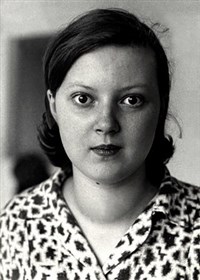 БОЛЬНАЯ ДИФФУЗНЫМ ТОКСИЧЕСКИМ ЗОБОМ