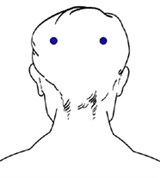 Биоэнерготерапия (методы лечения) (припечатывание)