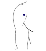 Биоэнерготерапия при гипертонии