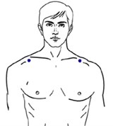 Биоэнерготерапия при радикулите (трапециевидная мышца)