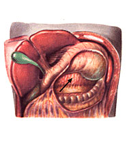 Брюшная полость в разрезе