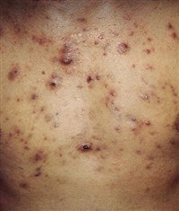 ВУЛЬГАРНЫЕ УГРИ