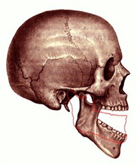 ВЫВИХ ВИСОЧНО-НИЖНЕЧЕЛЮСТНОГО СУСТАВА