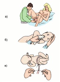 Внезапные роды