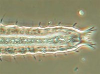 ГАСТРОТРИХИ (Брюхоресничный червь)