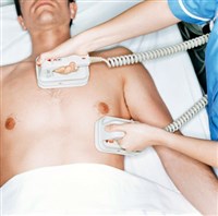 ДЕФИБРИЛЛЯЦИЯ СЕРДЦА