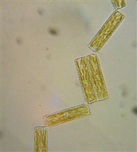 ДИАТОМОВЫЕ ВОДОРОСЛИ (Диатома обыкновенная)
