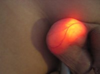 Диафаноскопия