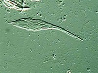 ЖИВОТНЫЕ ЖГУТИКОНОСЦЫ (Жгутиконосец)