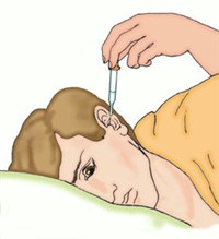 ЗАКАПЫВАНИЕ МАСЛА В УХО