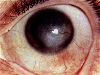 ИСХОД В БЕЛЬМО