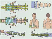 Иммобилизация (подручные средства)