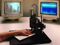 КАПИЛЛЯРОСКОПИЯ