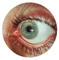 КОНТАКТНАЯ ЛИНЗА