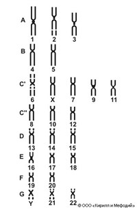 Кариограмма