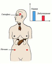 Климакс женский