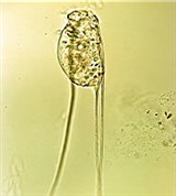 Коловратки (Филиния остроконечная)