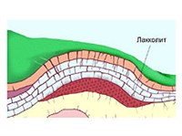 ЛАККОЛИТ (схема)