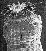 Ленточные черви (Гельминт)