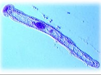 МЕЗОЗОИ (Дициемида)