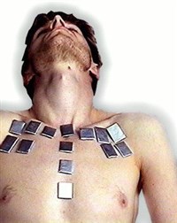 МЕТАЛЛОТЕРАПИЯ