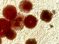 МИКОПЛАЗМЫ (Микоплазма)