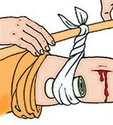 Наложение жгута (жгут «закрутка»)