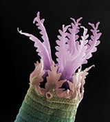 Нематоды (Голова рабдитии Acrobeles complexus)