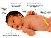 Новорожденный