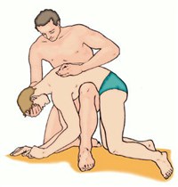 ОСВОБОЖДЕНИЕ ДЫХАТЕЛЬНЫХ ПУТЕЙ И ЖЕЛУДКА ОТ ВОДЫ