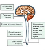 Опухоль в задней черепной ямке
