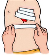 Остановка кровотечения при ранениях грудной клетки