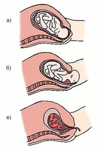 ПЕРИОДЫ РОДОВ