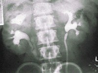 ПИЕЛОГРАФИЯ